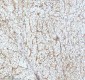 Anti-GCLM Rabbit Monoclonal Antibody